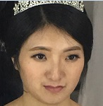 profile2